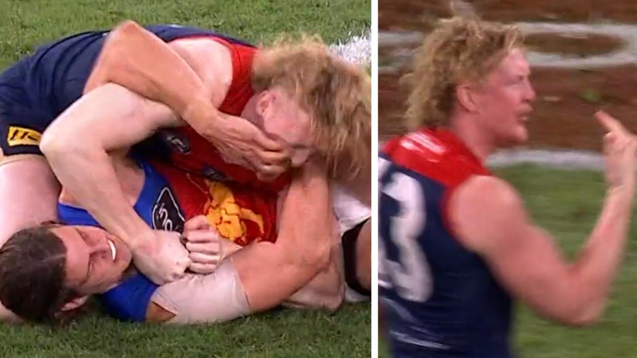Melbourne midfielder Clayton Oliver appeared to suggest he'd been eye gouged.