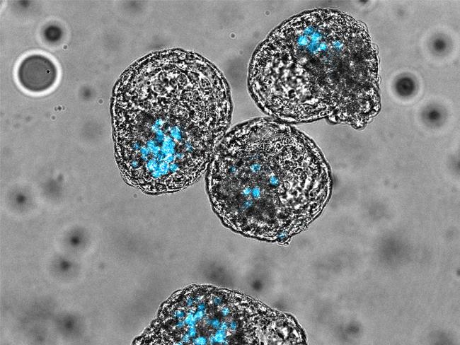 iBlastoids - Models of early human embryos. Supplied Monash University