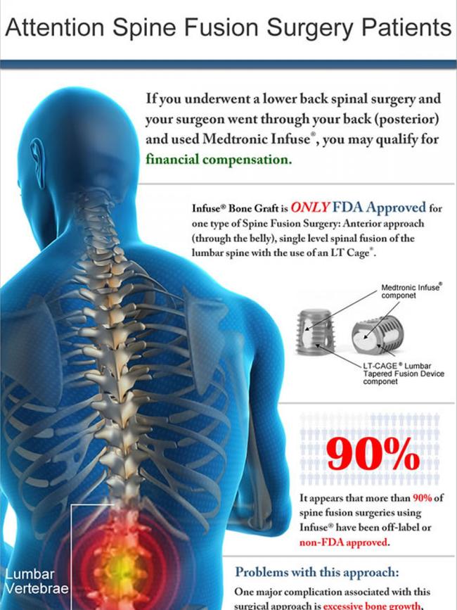 Advertisements in the US targeting patients adversely affected by the implants.