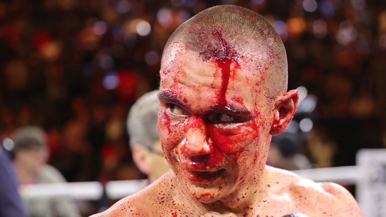 LAS VEGAS, NEVADA - MARCH 30: WBO junior middleweight champion Tim Tszyu (L) walks to his corner after a 12-round fight against Sebastian Fundora at T-Mobile Arena on March 30, 2024 in Las Vegas, Nevada. Fundora won Tszyu's title and a vacant WBC title by split decision. (Photo by Steve Marcus/Getty Images)