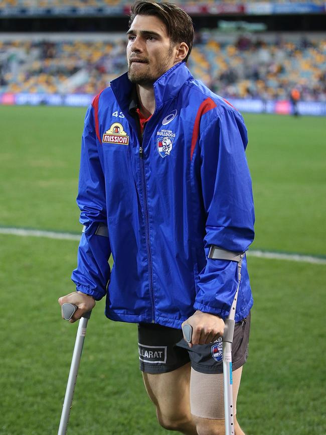 He finished the match on crutches. Picture: Getty