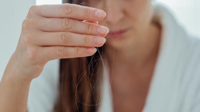 Do not take the advice of your hairdresser, your friend next door, a trichologist or a hair-loss clinic. Picture: Getty Images