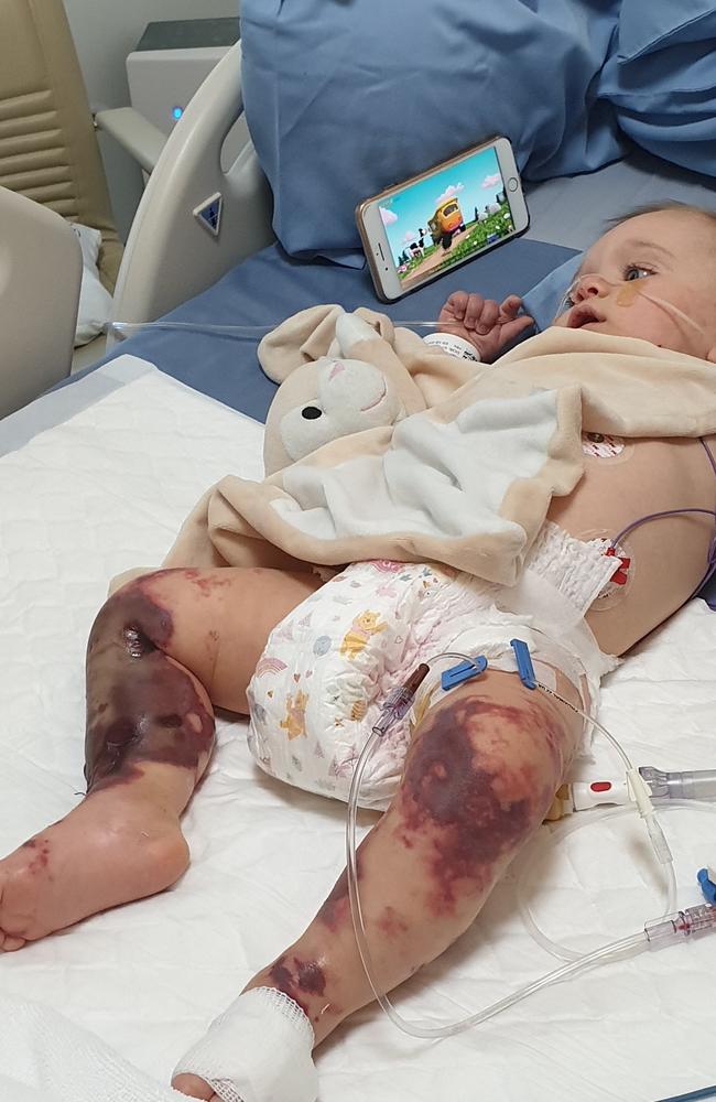 Baby Lilliana Sheridan has infections in both of her legs after contracting meningococcal while in Thailand on holiday with her Gold Coast family. They want to bring her home to Australia as Thai doctors talk about possible amputation.