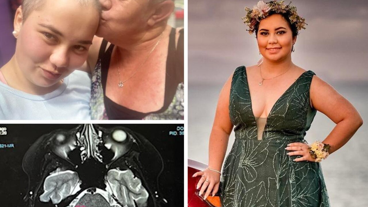 A Mackay teen and champion lawn bowler was having trouble seeing across the green, but an optical appointment turned into a waking nightmare after a brain tumour was discovered behind her eye.