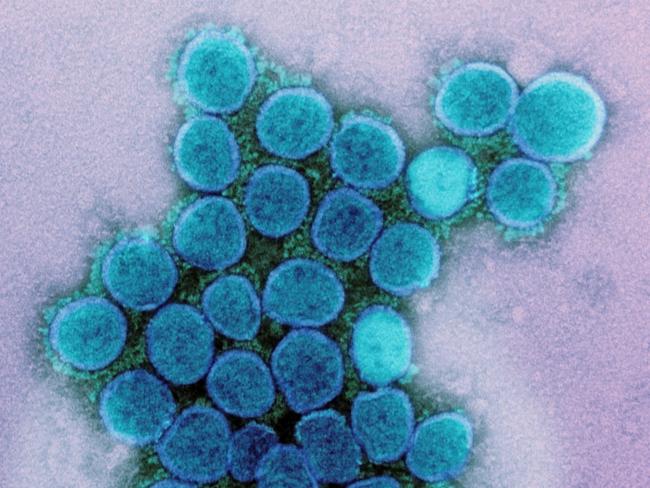 ONE TIME WEB USE FOR NEWS.COM.AU ONLY - FEES APPLY FOR REUSE - MUST DOWNLOAD ON YOUR OWN ACCOUNT -  2GBTXCF Transmission electron micrograph of a variant strain of SARS-CoV-2 virus particles (UK B.1.1.7), isolated from a patient sample and cultivated in cell culture. Image captured at the NIAID Integrated Research Facility (IRF) in Fort Detrick, Maryland. Picture: NIAID/Alamy