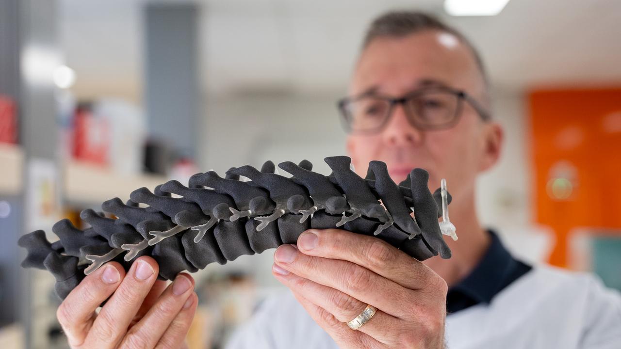 Griffith University professor James St John with a 3D model of a spine