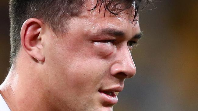 Joey Manu suffered a fractured cheekbone after a shot from Latrell Mitchell. Picture: Chris Hyde/Getty Images