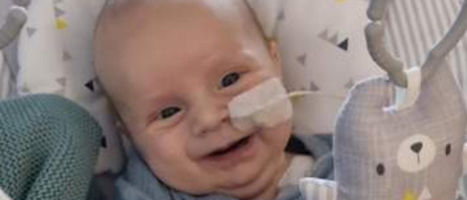 Sunshine Coast baby Charlie Dunn born with his intestines outside of his body. Picture – contributed.