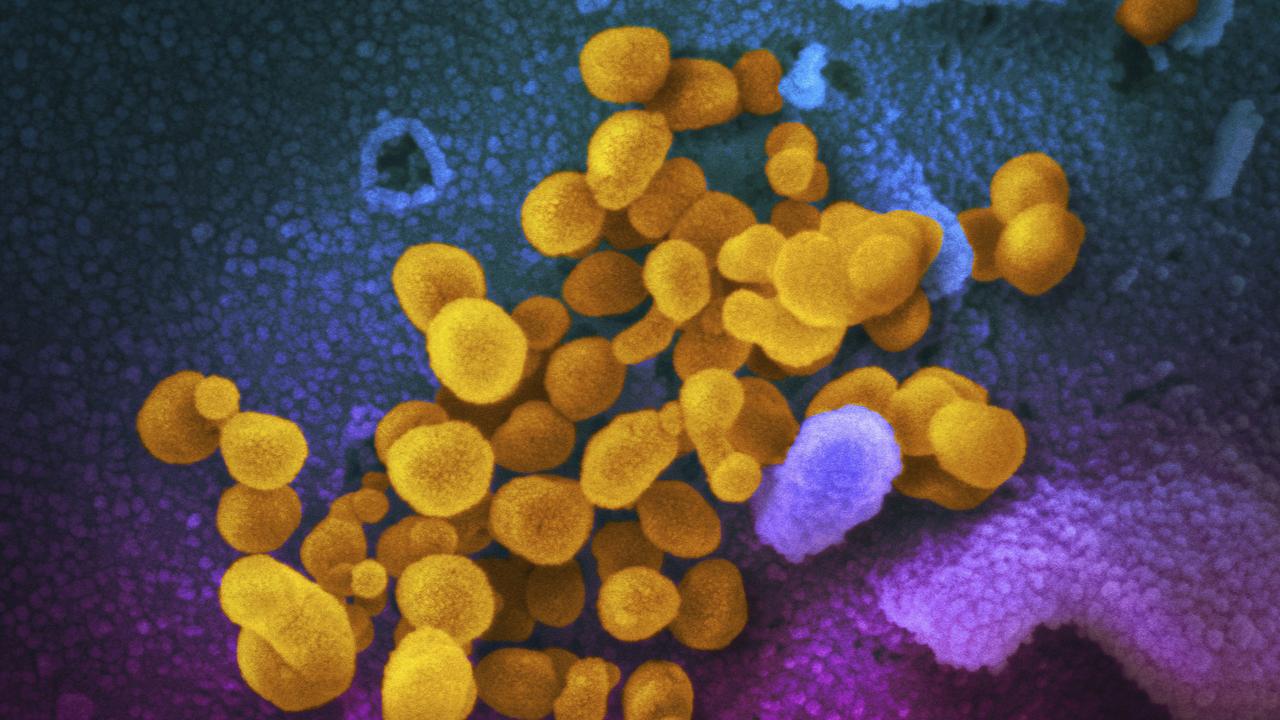 The coronavirus SARS-CoV-2, yellow, emerging from the surface of cells, blue/pink, cultured in the lab.