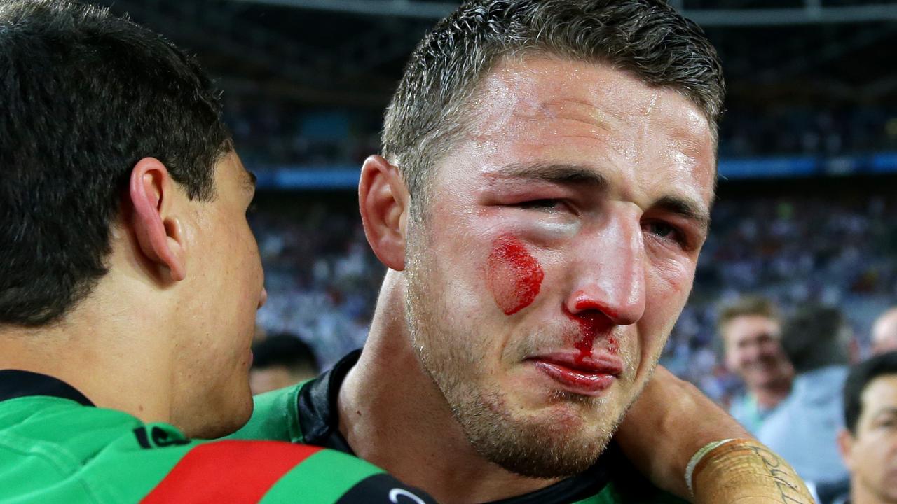 Sam Burgess could have lost an eye in the 2014 Grand Final.
