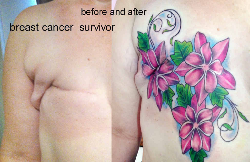 Turning breast cancer scars into beautiful tattoo art