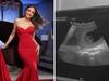 Channel 7 star reveals pregnancy battle