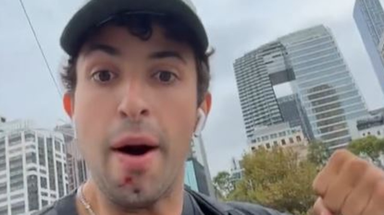 ‘A guy just comes – boom’: Canadian tourist’s random CBD attack