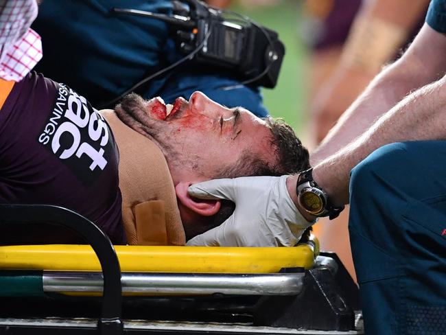 Corey Oates is treated by medical staff after being injured.