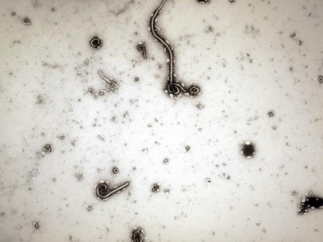 The Ebola virus viewed through an electron microscope. Picture: Antwerp Institute of Tropical Medicine