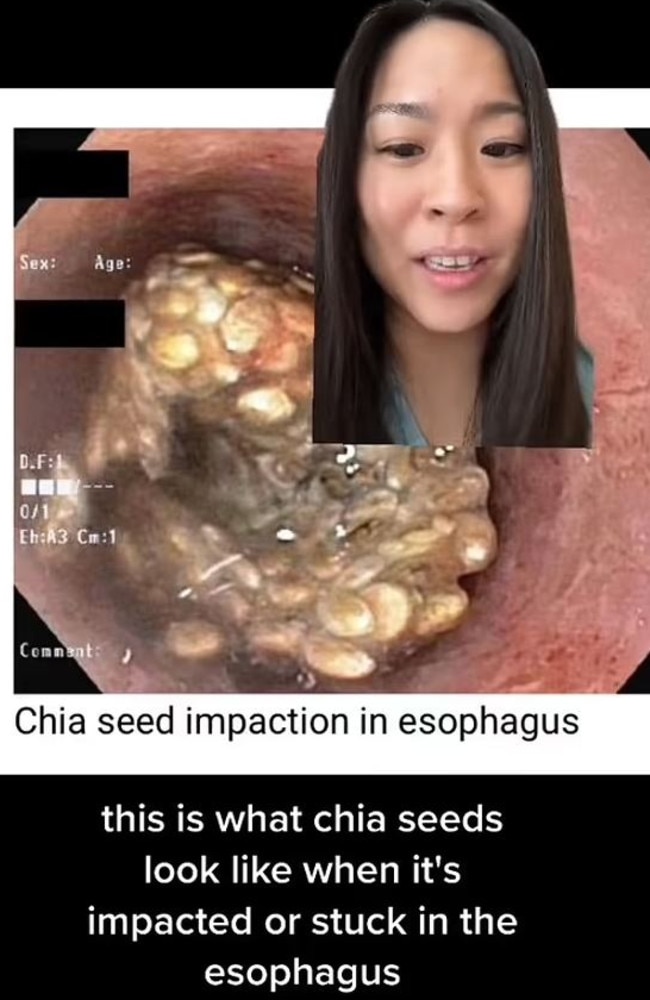 Experts have issued a warning about a common mistake some people make when eating chia seeds. Picture: TikTok