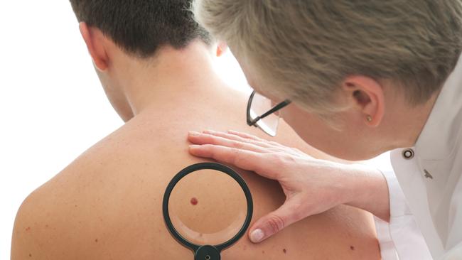 Dermatologist examines a mole of male patient