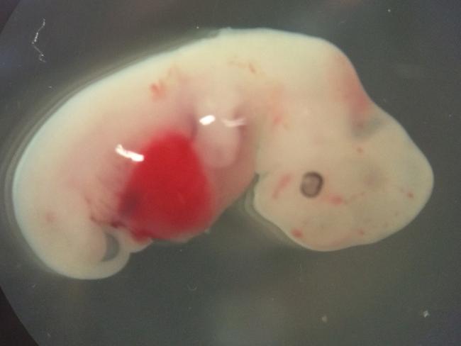 This undated photo provided by the Salk Institute on Jan. 24, 2017 shows a 4-week-old pig embryo which had been injected with human stem cells. The experiment was a very early step toward the possibility of growing human organs inside animals for transplantation. (Salk Institute via AP)