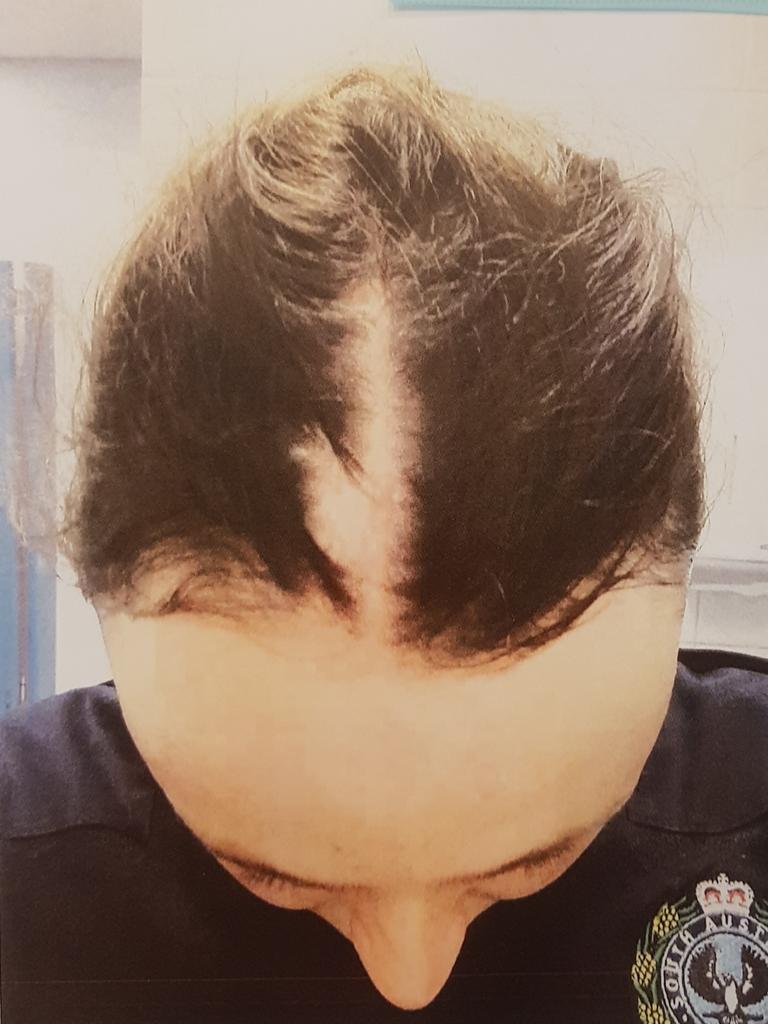 Ms Beck, who was pregnant at the time of the attack, had a chunk of hair ripped from her scalp. Picture: District Court registry
