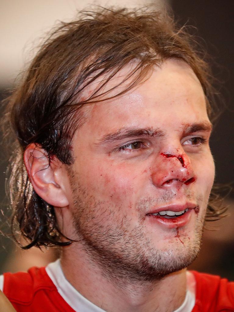 Hunter Clark’s cuts after the game. Picture: AFL Photos/Getty Images