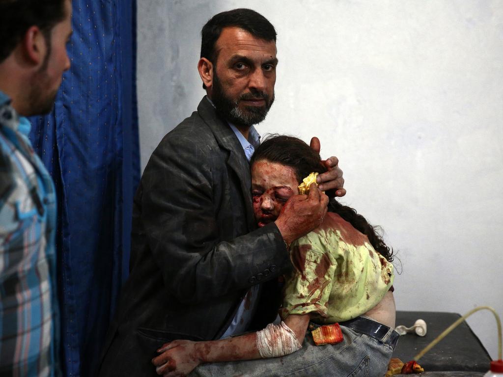 “Douma’s Children, Syria” by photographer Abd Doumany for AFP which won the second prize in the General News stories category shows a wounded Syrian girl holding on to a relative as she awaits treatment by doctors at a makeshift hospital in Douma, Syria, May 11, 2015. (Abd Doumany/AFP, World Press Photo via AP)