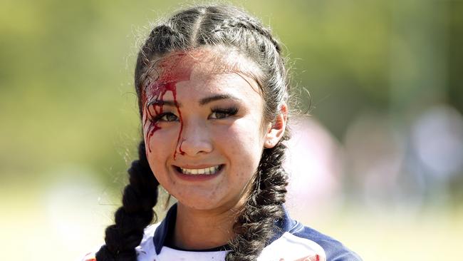 Lani Anderson from Philippines with an injury from the game. 16 Girls Tonga v Philippines. Harmony Nines Rugby League. Picture: John Appleyard