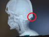 X-ray reveals why Gen Z are ‘cooked’