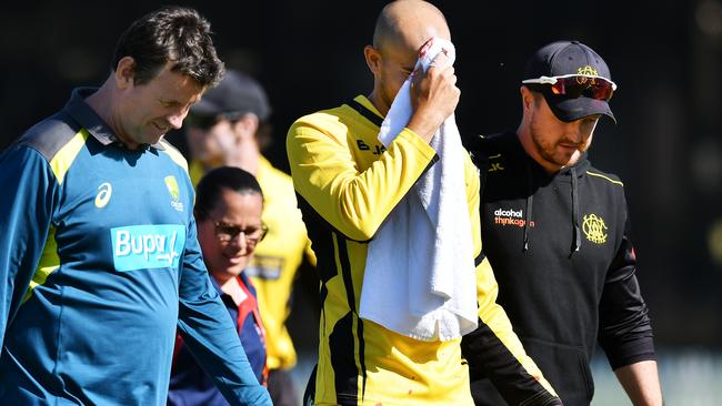 Ashton Agar leaves the field after the blow.