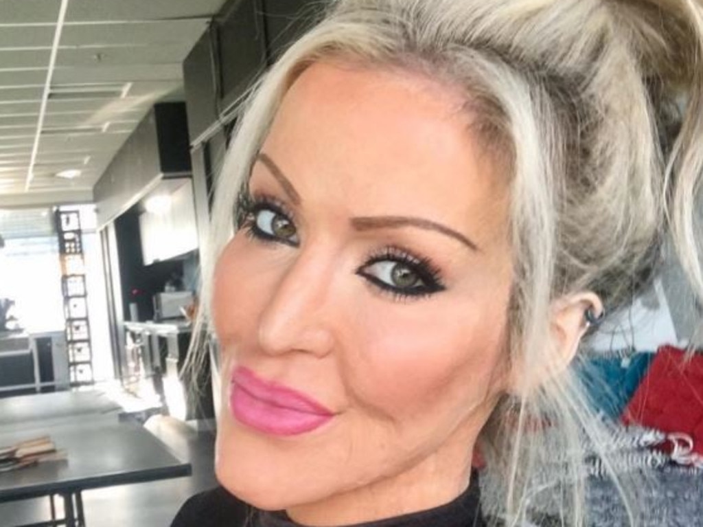 Burn assault victim Dana Vulin was stalked on social media for 5 years