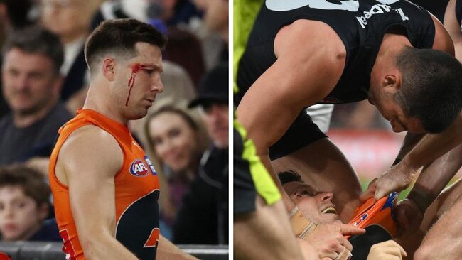 Toby Greene was left bloodied after the incident involved Carlton’s Jacob Weitering. Photos: Michael Klein and Getty Images