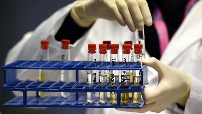 Australian Clinical Labs is expected to list on a deferred settlement basis on May 14. Picture: AFP)