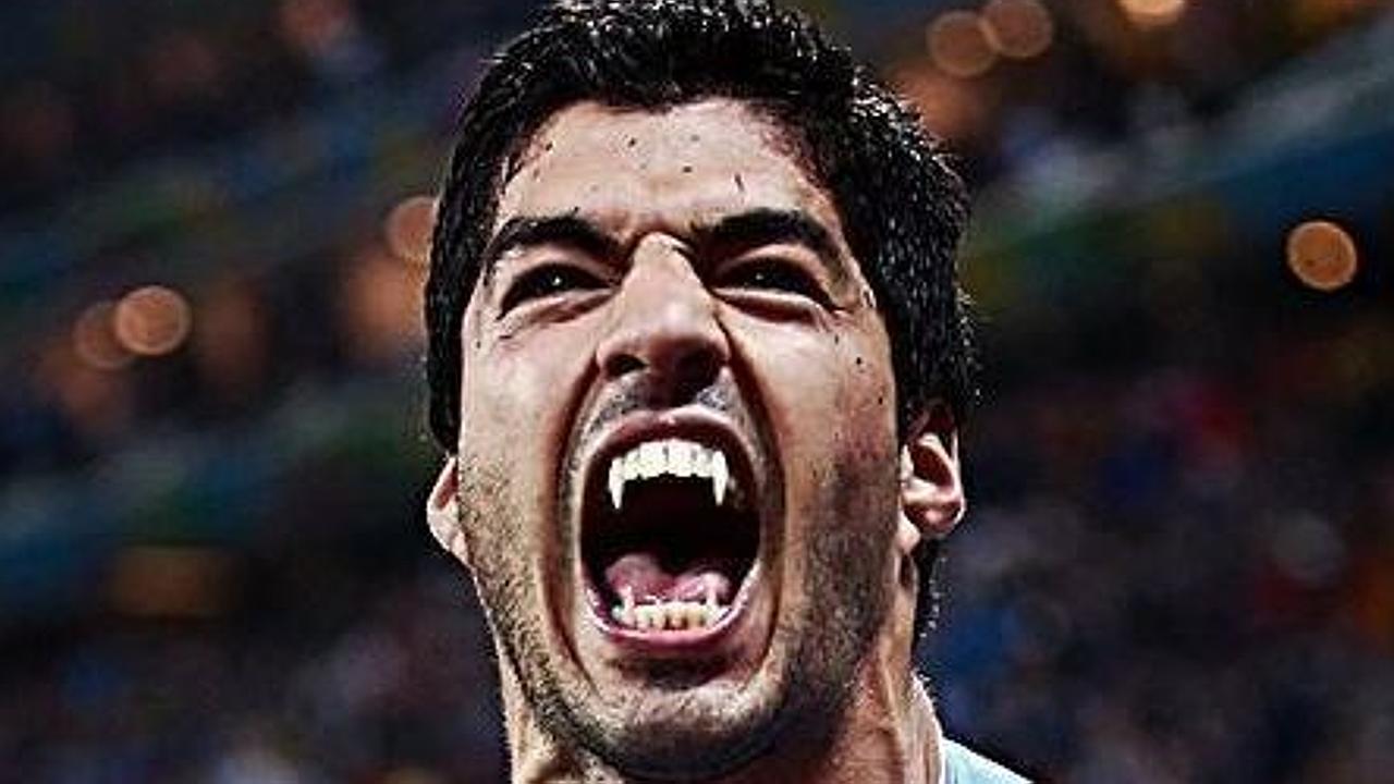 Luis on sale suarez bite