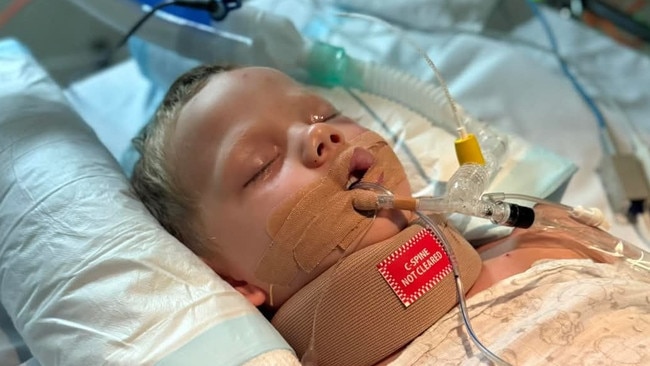 The four-year-old was treated by paramedics at the scene for a suspected head injury. Picture: GoFundMe