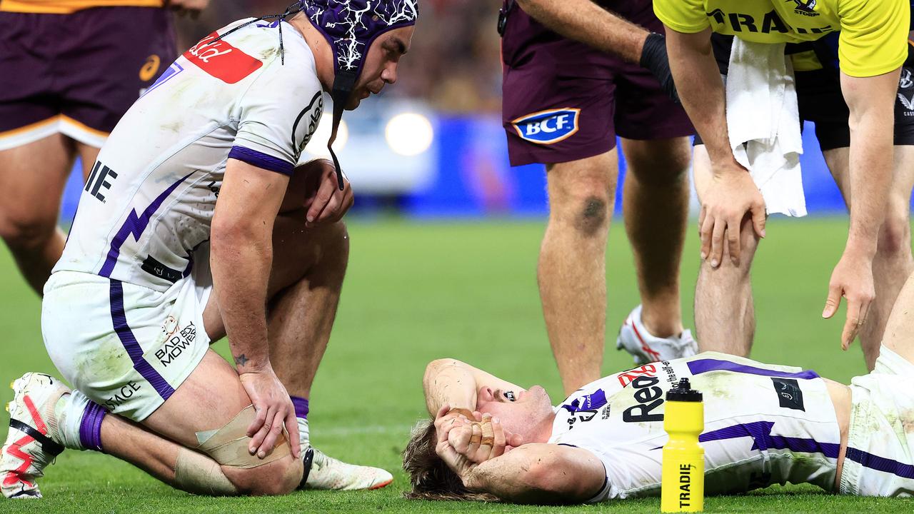 Ryan Papenhuyzen suffered a serious leg injury on Friday night. Picture: Adam Head