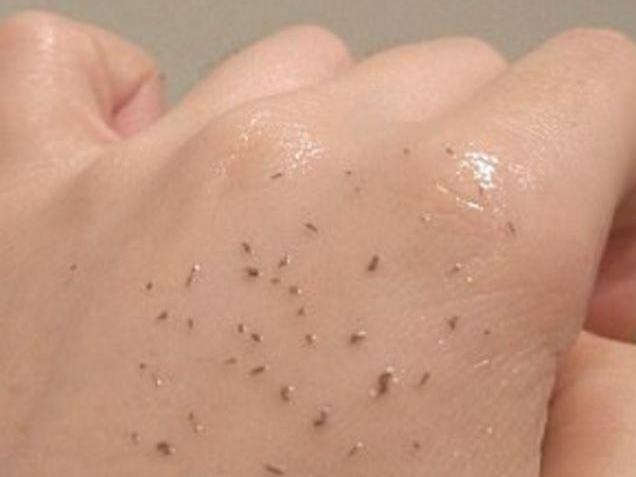 The blackheads are removed used an oil-based cleanser. Picture: Reddit