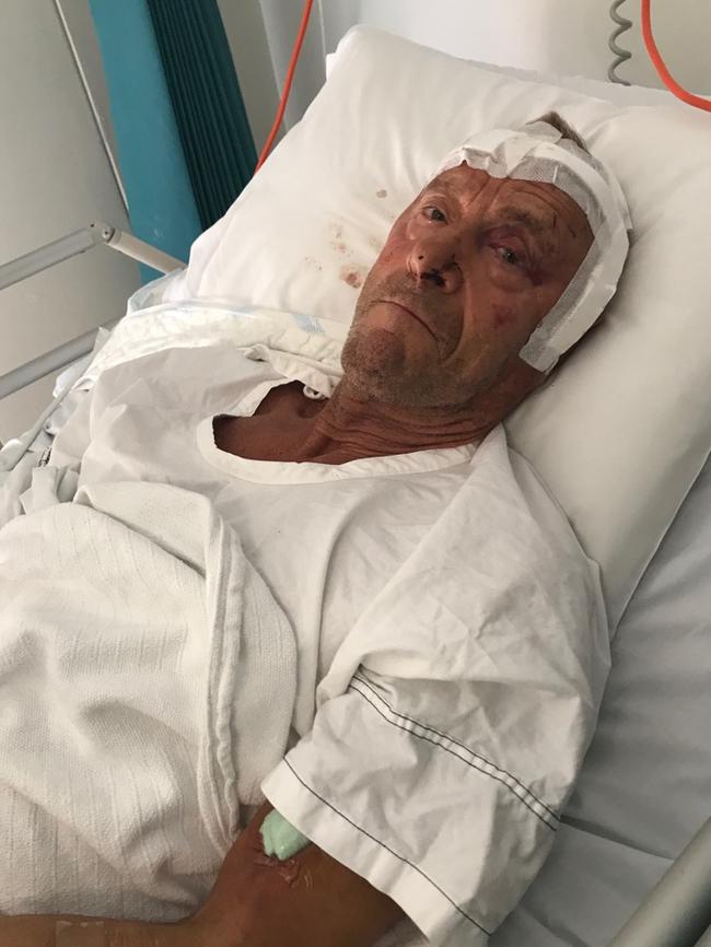 The pensioner’s skull had been fractured in the attack.