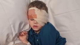 Six days after visiting an eye specialist Kayden’s left eye was removed.