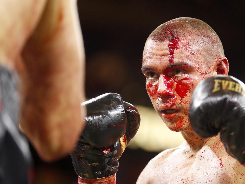 Tim Tszyu bled heavily from the end of the second round. Picture: Getty