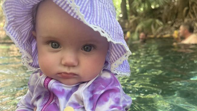 NT toddler Zahli Rose Brown will likely undergo open brain surgery after a tumour was discovered just days after her first birthday. Picture: Supplied.