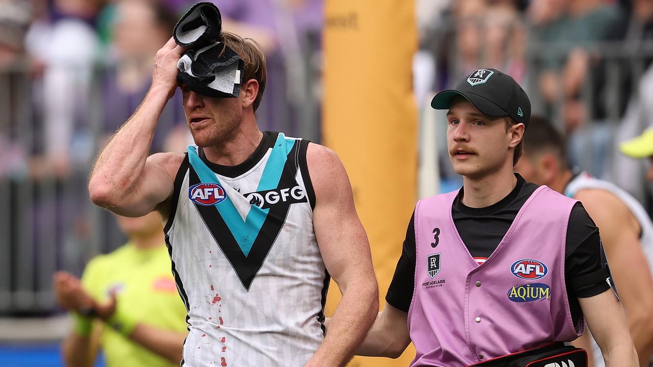 Tom Jonas comes from the field after a head knock. Picture: Paul Kane/Getty Images