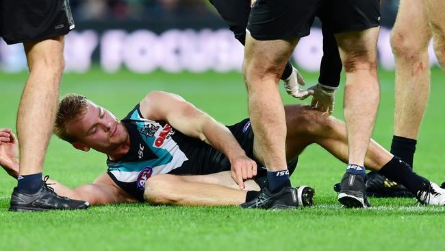 Jack Watts after his serious ankle injury on Saturday. Picture: Mark Brake/Getty Images