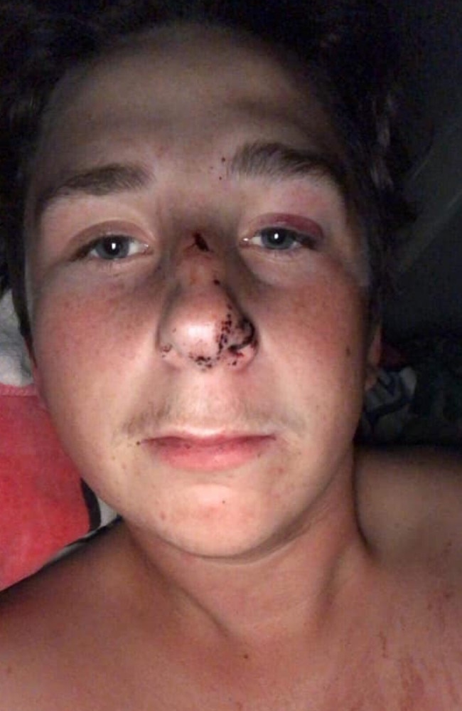 A young man was left bloodied and bruised after the attack. Picture: Facebook.