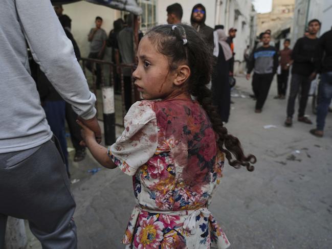 A young Palestinian girl injured in an Israeli air strike is brought for a treatment at the Baptist Hospital in Gaza City. Picture: AP