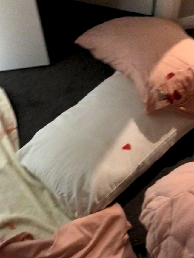 Pictures from a video taken by the woman showing blood on her bed after the assault.