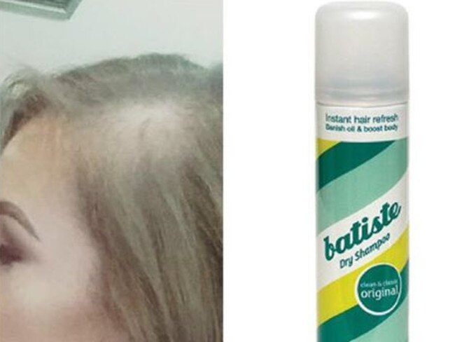 Batiste dry shampoo: Woman goes bald after using  —  Australia's leading news site