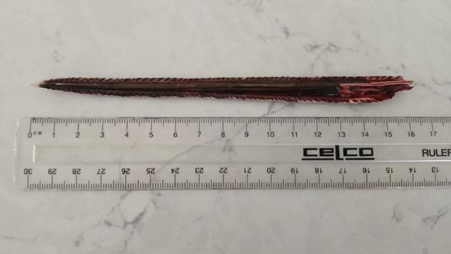 A stingray barb that had to be surgically removed from Pam Bennett's arm. Picture: Pam Bennett
