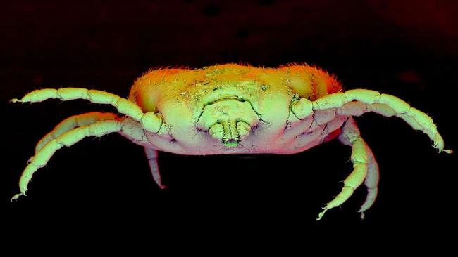 Electron microscope images of a tick.