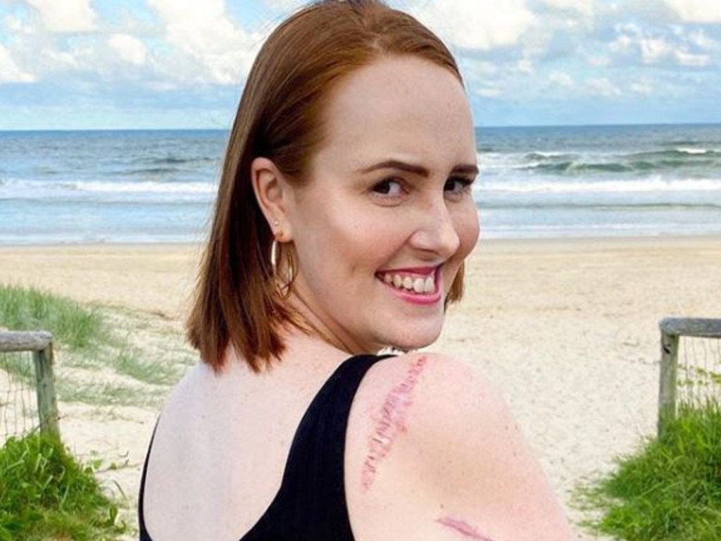 Courtney is currently cancer free but warns others to regularly get their skin checked after the recent SpotChecker Australian Skin Safety Report revealed 35 per cent of Aussies have never had their skin checked. Picture: Supplied