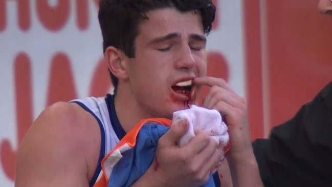 Fremantle Docker Andrew Brayshaw points to his teeth after being hit by Andrew Gaff in Round 20.