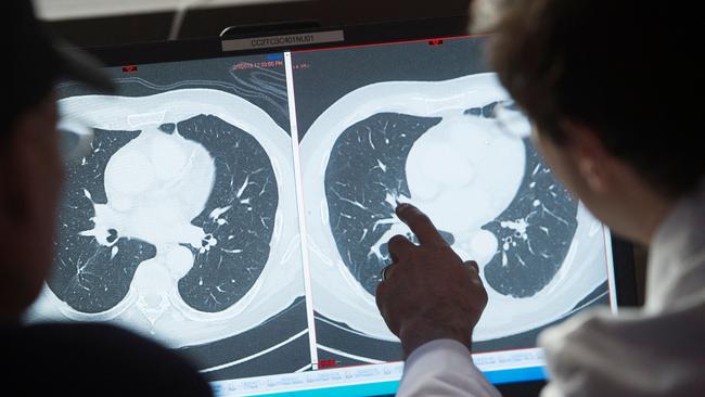 A doctor and patient examine CT scans. Telix’s Illiccix can detect prostate cancer more accurately and earlier. Picture: AFP